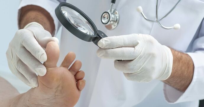 Diagnostični pregled nohtov na nogah