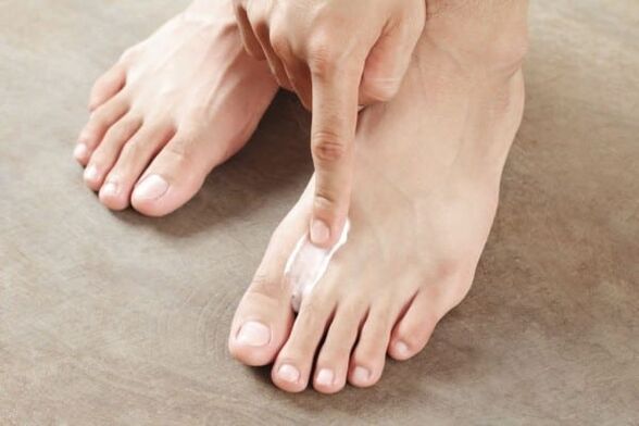 nanos mazila iz glivic kože na nogah